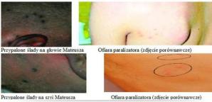 [VIDEO] Okryli prawdę o Lechu Wałęsie. Teraz zajmą się sprawą śmierci 19-letniego Mateusza Leszczyńskiego. Czy zauważą, że został zabity paralizatorami?